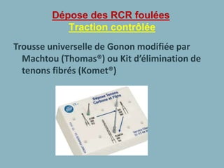 Dépose des RCR foulées
Traction contrôlée
Trousse universelle de Gonon modifiée par
Machtou (Thomas®) ou Kit d’élimination de
tenons fibrés (Komet®)
 