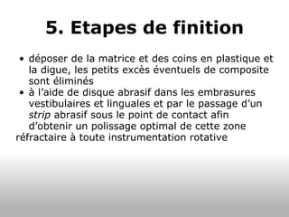 5. Etapes de finition déposer de la matrice et des coins en plastique et la digue, les petits excès éventuels de composite sont éliminés à l’aide de disque abrasif dans les embrasures vestibulaires et linguales et par le passage d’un  strip  abrasif sous le point de contact afin d’obtenir un polissage optimal de cette zone réfractaire à toute instrumentation rotative 