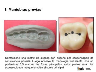 1. Maniobras previas
Confeccione una matriz de silicona con silicona por condensación de
consistencia pesada. Luego observe la morfología del diente, con un
portaminas 0,5 marque las fosas principales, estos puntos serán los
accesos, luego marque también el surco principal.
 