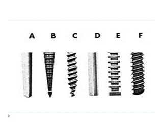 Restoration of endodontically treated teeth | PPTX