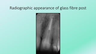 Glass Radiograph Restoration of endodontically treated teeth | PPTX