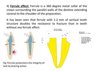 Restoration of endodontically treated teeth | PPTX