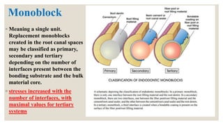 Restoration of endodontically treated teeth | PDF
