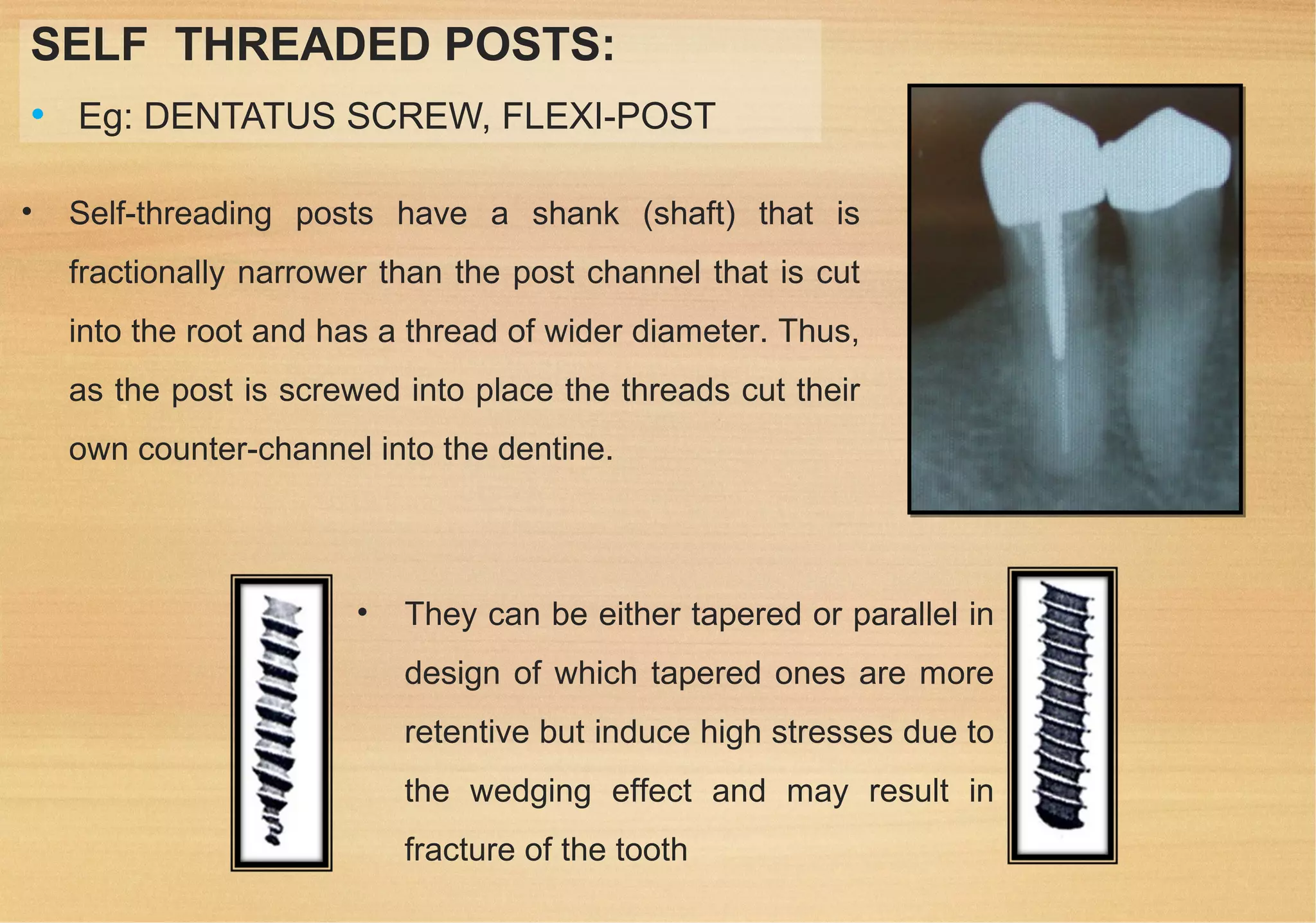 Restoration of endodontically treated teeth | PPT