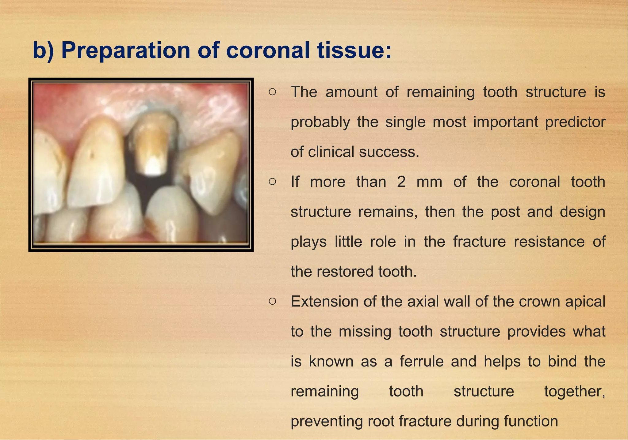 Restoration of endodontically treated teeth. | PPT