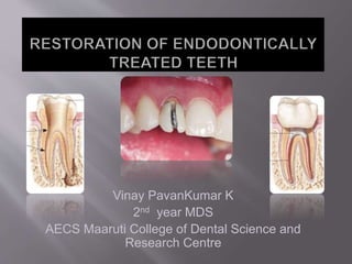 Vinay PavanKumar K
2nd year MDS
AECS Maaruti College of Dental Science and
Research Centre
 