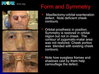 Restoration of facial defects basic priniciples | PPT