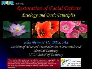 John Beumer III DDS, MS Division of Advanced Prosthodontics, Biomaterials and Hospital Dentistry UCLA School of Dentistry Restoration of Facial Defects Etiology and Basic Principles * The material in this program of instruction is protected by copyright ©.  No part of this program of instruction  may be reproduced, recorded, or transmitted by any means, electronic,digital, photographic, mechanical, etc. or by any information storage or retrieval system, without prior permission. 