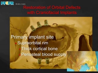 Restoration of orbital defects | PDF