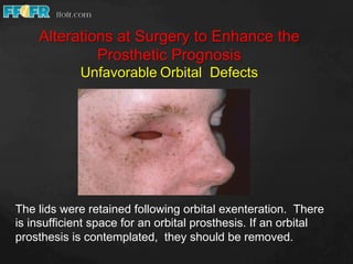 Restoration of orbital defects | PDF