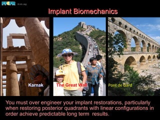  
	
  	
  	
  	
  	
  	
  	
  
Karnak The Great Wall Pont	
  de	
  Gard	
  
You must over engineer your implant restorations, particularly
when restoring posterior quadrants with linear configurations in
order achieve predictable long term results.
Implant Biomechanics
 