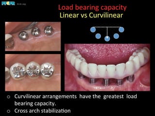 Load	
  bearing	
  capacity	
  
	
  	
  Linear	
  vs	
  Curvilinear	
  
o  Curvilinear	
  arrangements	
  	
  have	
  the	
  	
  greatest	
  	
  load	
  
bearing	
  capacity.	
  
o  Cross	
  arch	
  stabiliza(on	
  
 