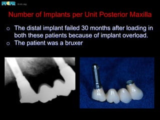 Number of Implants per Unit Posterior Maxilla
o  The distal implant failed 30 months after loading in
both these patients because of implant overload.
o  The patient was a bruxer
 