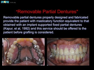 *Removable Partial Dentures*
Removable partial dentures properly designed and fabricated
provide the patient with masticatory function equivalent to that
obtained with an implant supported fixed partial dentures
(Kapur, et al, 1992) and this service should be offered to the
patient before grafting is considered.
 