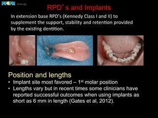 RPD’s and Implants
Position and lengths
•  Implant site most favored – 1st molar position
•  Lengths vary but in recent times some clinicians have
reported successful outcomes when using implants as
short as 6 mm in length (Gates et al, 2012).
In	
  extension	
  base	
  RPD’s	
  (Kennedy	
  Class	
  I	
  and	
  II)	
  to	
  
supplement	
  the	
  support,	
  stability	
  and	
  reten(on	
  provided	
  
by	
  the	
  exis(ng	
  den((on.	
  	
  	
  	
  
 