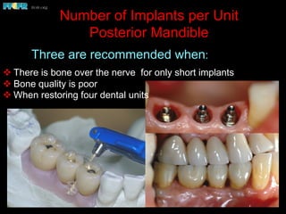 Number of Implants per Unit
Posterior Mandible
v There is bone over the nerve for only short implants
v Bone quality is poor
v When restoring four dental units
Three are recommended when:
 