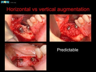 Horizontal vs vertical augmentation
Predictable
 