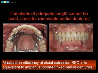 If implants of adequate length cannot be
used, consider removable partial dentures
Mastication efficiency of distal extension RPD’s is
equivalent to implant supported fixed partial dentures.
 