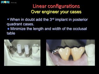  When in doubt add the 3rd implant in posterior
quadrant cases.
 Minimize the length and width of the occlusal
table
Linear	
  conﬁgura(ons
Over engineer your cases
 