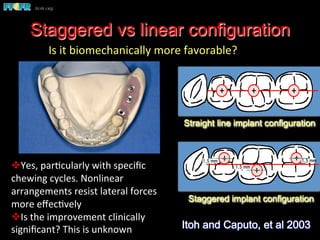 Staggered vs linear configuration
Staggered implant configuration
1.5 mm
1.5 mm 1.5 mm
Straight line implant configuration
Itoh and Caputo, et al 2003
Is	
  it	
  biomechanically	
  more	
  favorable?	
  
	
  
v Yes,	
  par(cularly	
  with	
  speciﬁc	
  
chewing	
  cycles.	
  Nonlinear	
  
arrangements	
  resist	
  lateral	
  forces	
  
more	
  eﬀec(vely	
  
v Is	
  the	
  improvement	
  clinically	
  
signiﬁcant?	
  This	
  is	
  unknown	
  
 