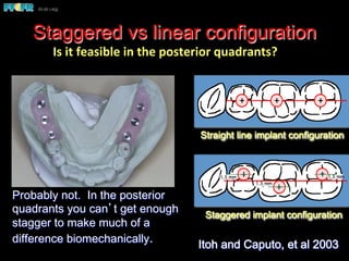Staggered vs linear configuration
Staggered implant configuration
1.5 mm
1.5 mm 1.5 mm
Straight line implant configuration
Probably not. In the posterior
quadrants you can’t get enough
stagger to make much of a
difference biomechanically. Itoh and Caputo, et al 2003
Is	
  it	
  feasible	
  in	
  the	
  posterior	
  quadrants?	
  
 