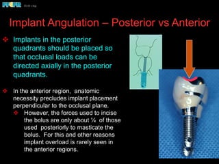 Implant Angulation – Posterior vs Anterior
v  Implants in the posterior
quadrants should be placed so
that occlusal loads can be
directed axially in the posterior
quadrants.
v  In the anterior region, anatomic
necessity precludes implant placement
perpendicular to the occlusal plane.
v  However, the forces used to incise
the bolus are only about ¼ of those
used posteriorly to masticate the
bolus. For this and other reasons
implant overload is rarely seen in
the anterior regions.
 