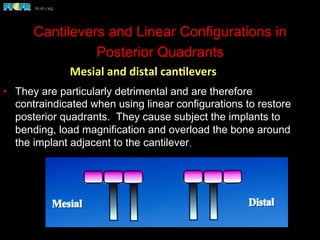 Cantilevers and Linear Configurations in
Posterior Quadrants
•  They are particularly detrimental and are therefore
contraindicated when using linear configurations to restore
posterior quadrants. They cause subject the implants to
bending, load magnification and overload the bone around
the implant adjacent to the cantilever.
Mesial	
  and	
  distal	
  canClevers	
  
 
