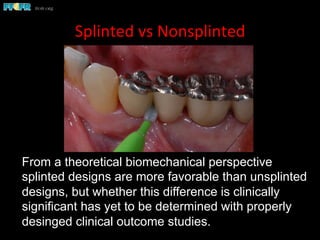 Splinted	
  vs	
  Nonsplinted	
  
From a theoretical biomechanical perspective
splinted designs are more favorable than unsplinted
designs, but whether this difference is clinically
significant has yet to be determined with properly
desinged clinical outcome studies.
 