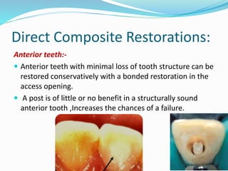 Restoration of the endodontically treated tooth | PPTX