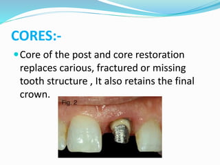 Teeth Core Restoration of the endodontically treated tooth | PPTX