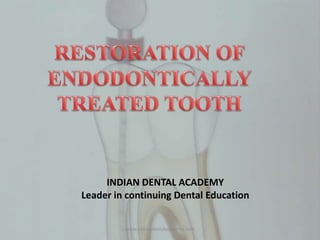 INDIAN DENTAL ACADEMY
Leader in continuing Dental Education
www.indiandentalacademy.com
 