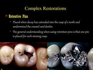 Retentive Pin Restorative and esthetic dentistry | PPT
