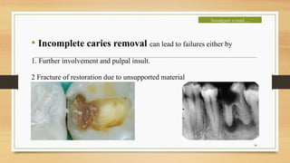 Restorative Failures and retreatment for each material | PPTX