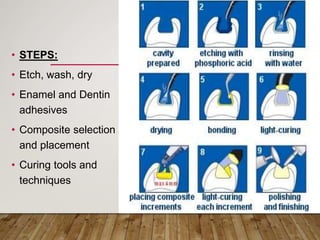 • STEPS:
• Etch, wash, dry
• Enamel and Dentin
adhesives
• Composite selection
and placement
• Curing tools and
techniques
 