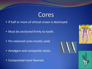 Acid etch technique Most effective way of improving marginal seal between resin and enamel                                Mode of action-Creates microporosities by discrete etching of enamelEtching increases surface areaEtched enamel allow resin to wet the tooth surface betterWhen polymerised forms resin tags              Acid used-37% phosphoric acid