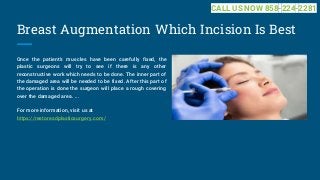 Breast Augmentation Which Incision Is Best
Once the patient's muscles have been carefully fixed, the
plastic surgeons will try to see if there is any other
reconstructive work which needs to be done. The inner part of
the damaged area will be needed to be fixed. After this part of
the operation is done the surgeon will place a rough covering
over the damaged area. ...
For more information, visit us at
https://restoresdplasticsurgery.com/
CALL US NOW 858-224-2281
 