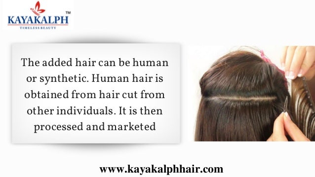 Hair Weaving In Bangalore Hair Replacement In India