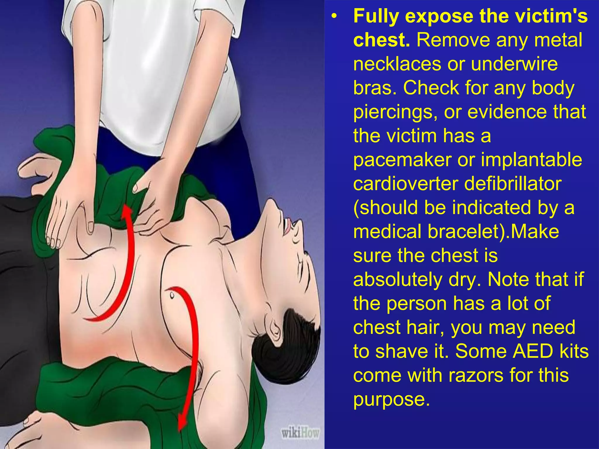 • Fully expose the victim's 
chest. Remove any metal 
necklaces or underwire 
bras. Check for any body 
piercings, or evidence that 
the victim has a 
pacemaker or implantable 
cardioverter defibrillator 
(should be indicated by a 
medical bracelet).Make 
sure the chest is 
absolutely dry. Note that if 
the person has a lot of 
chest hair, you may need 
to shave it. Some AED kits 
come with razors for this 
purpose. 
 