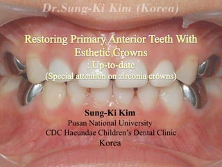 Sung-Ki Kim
Pusan National University
CDC Haeundae Children’s Dental Clinic

Korea

 