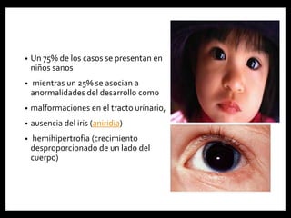 • Un 75% de los casos se presentan en
niños sanos
• mientras un 25% se asocian a
anormalidades del desarrollo como
• malformaciones en el tracto urinario,
• ausencia del iris (aniridia)
• hemihipertrofia (crecimiento
desproporcionado de un lado del
cuerpo)
 