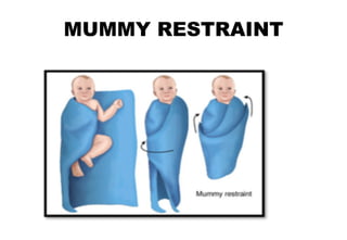 MUMMY RESTRAINT
 