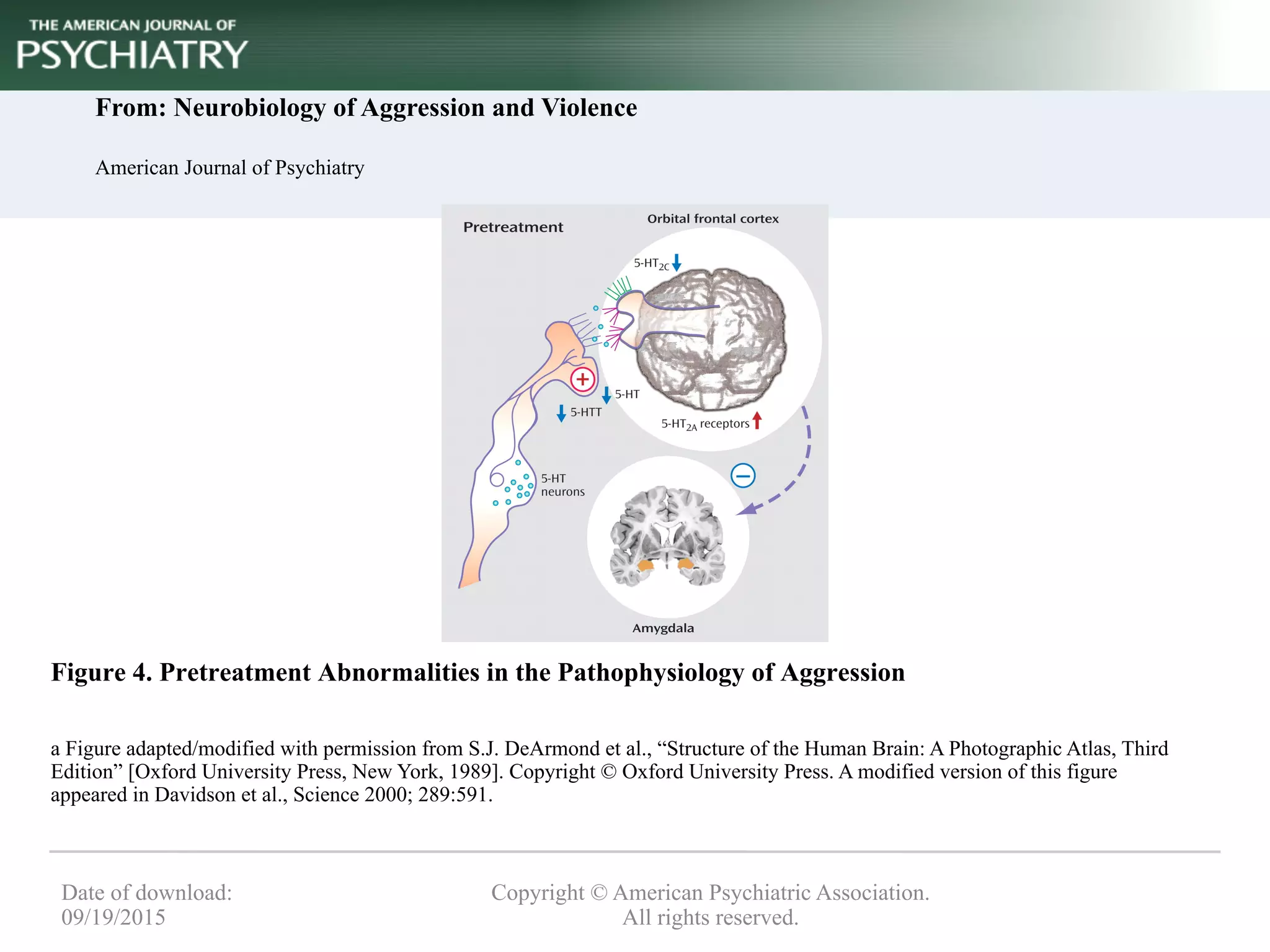 From: Neurobiology of Aggression and Violence
American Journal of Psychiatry
Figure 4. Pretreatment Abnormalities in the Pathophysiology of Aggression
a Figure adapted/modified with permission from S.J. DeArmond et al., “Structure of the Human Brain: A Photographic Atlas, Third
Edition” [Oxford University Press, New York, 1989]. Copyright © Oxford University Press. A modified version of this figure
appeared in Davidson et al., Science 2000; 289:591.
Copyright © American Psychiatric Association.
All rights reserved.
Date of download:
09/19/2015
 