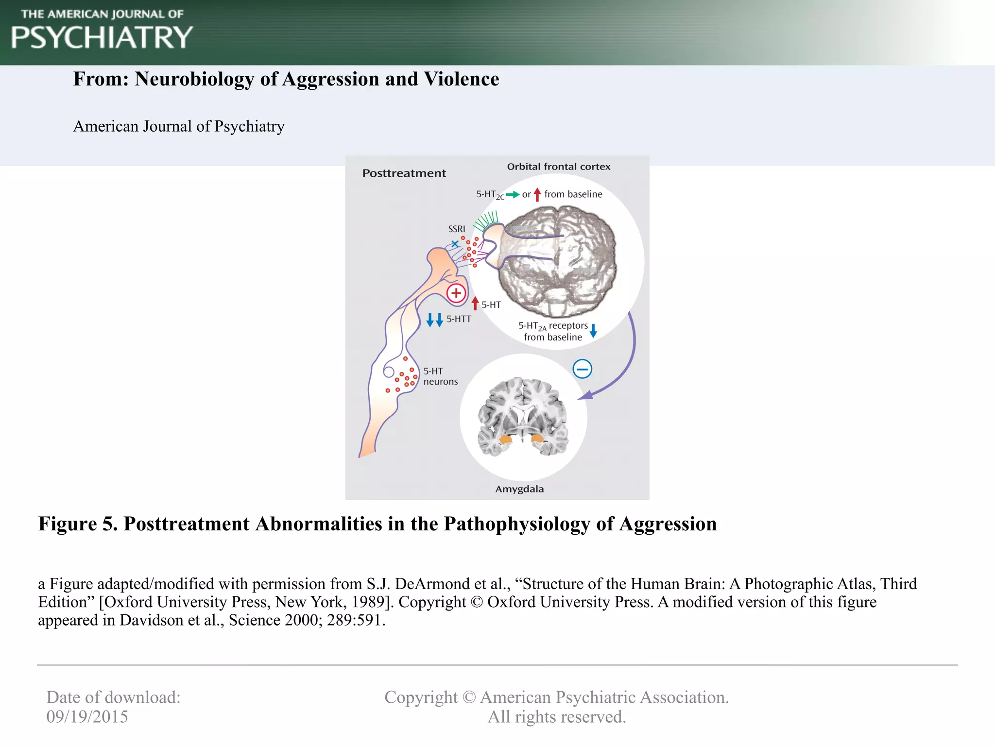 From: Neurobiology of Aggression and Violence
American Journal of Psychiatry
Figure 5. Posttreatment Abnormalities in the Pathophysiology of Aggression
a Figure adapted/modified with permission from S.J. DeArmond et al., “Structure of the Human Brain: A Photographic Atlas, Third
Edition” [Oxford University Press, New York, 1989]. Copyright © Oxford University Press. A modified version of this figure
appeared in Davidson et al., Science 2000; 289:591.
Copyright © American Psychiatric Association.
All rights reserved.
Date of download:
09/19/2015
 