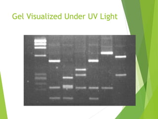Gel Visualized Under UV Light
 