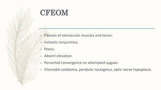 CFEOM
– Fibrosis of extraocular muscles and tenon.
– Inelastic conjunctiva.
– Ptosis.
– Absent elevation.
– Perverted convergence on attempted upgaze.
– Choroidal coloboma, pendular nystagmus, optic nerve hypoplasia.
 