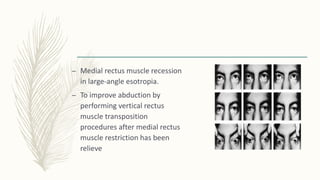 – Medial rectus muscle recession
in large-angle esotropia.
– To improve abduction by
performing vertical rectus
muscle transposition
procedures after medial rectus
muscle restriction has been
relieve
 