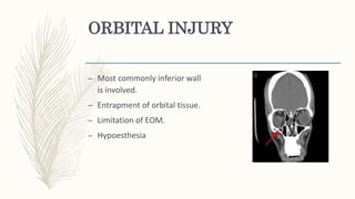 ORBITAL INJURY
– Most commonly inferior wall
is involved.
– Entrapment of orbital tissue.
– Limitation of EOM.
– Hypoesthesia
 