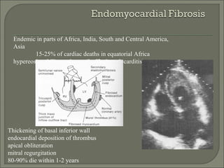 Endemic in parts of Africa, India, South and Central America,
Asia
15-25% of cardiac deaths in equatorial Africa
hypereosinophilic syndrome (Loffler’s endocarditis)
Thickening of basal inferior wall
endocardial deposition of thrombus
apical obliteration
mitral regurgitation
80-90% die within 1-2 years
 