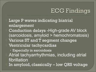  Large P waves indicating biatrial
enlargement
 Conduction delays -High-grade AV block
(sarcoidosis, amyloid > hemochromatosis)
 Various ST and T segment changes
 Ventricular tachycardias
• Especially in sarcoidosis
 Atrial tachyarrhythmias, including atrial
fibrillation
 In amyloid, classically – low QRS voltage
 