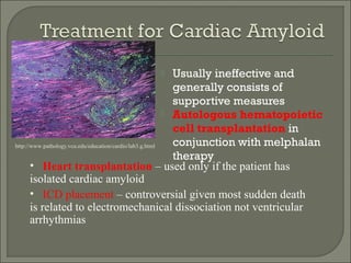  Usually ineffective and
generally consists of
supportive measures
 Autologous hematopoietic
cell transplantation in
conjunction with melphalan
therapy
• Heart transplantation – used only if the patient has
isolated cardiac amyloid
• ICD placement – controversial given most sudden death
is related to electromechanical dissociation not ventricular
arrhythmias
http://www.pathology.vcu.edu/education/cardio/lab3.g.html
 